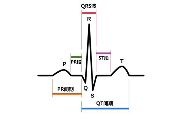 qrs复合波检测算法?qrs复合波减少